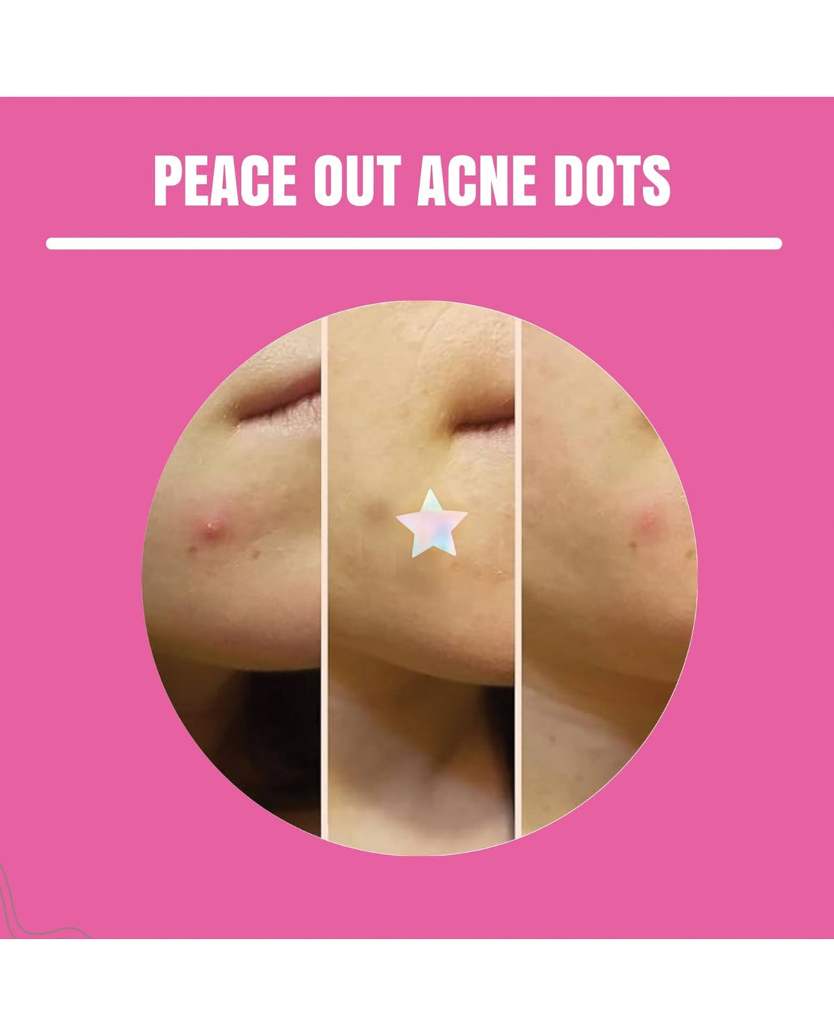 Neva Nude Unicorn Wishes Holographic Iridescent Star Hydrocolloid Acne Pimple Stickers 56 pk by Neva Nude